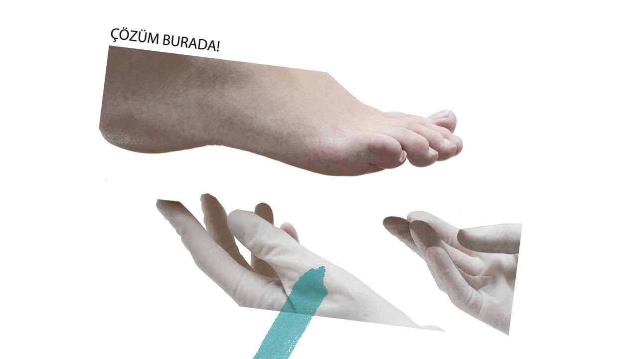 Topuk Dikeni Egzersizleri – 1 Topuk Dikeni Egzersizleri – 1