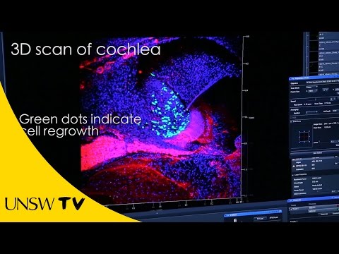 Bionic ear delivers DNA to regrow auditory nerve cells