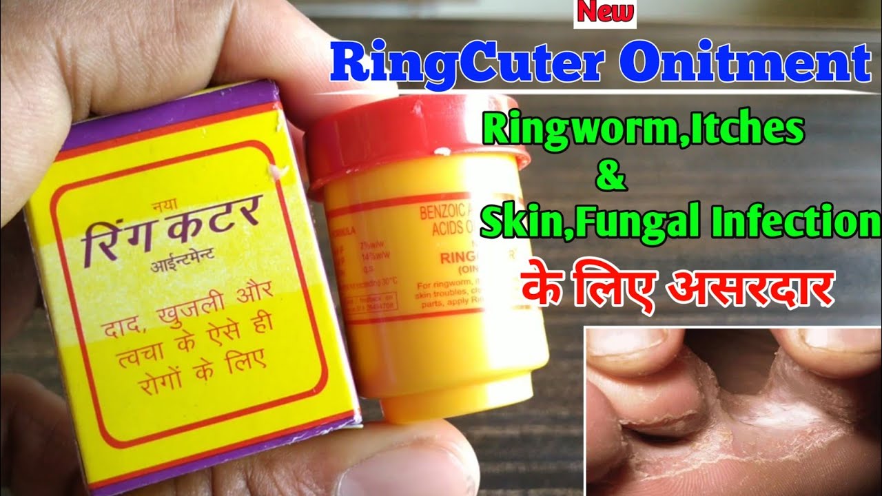 Ring Cutter Ointment Rudramani at Rs 100/piece in Surat | ID: 2853478974030