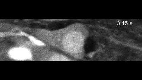 Neuron action potentials