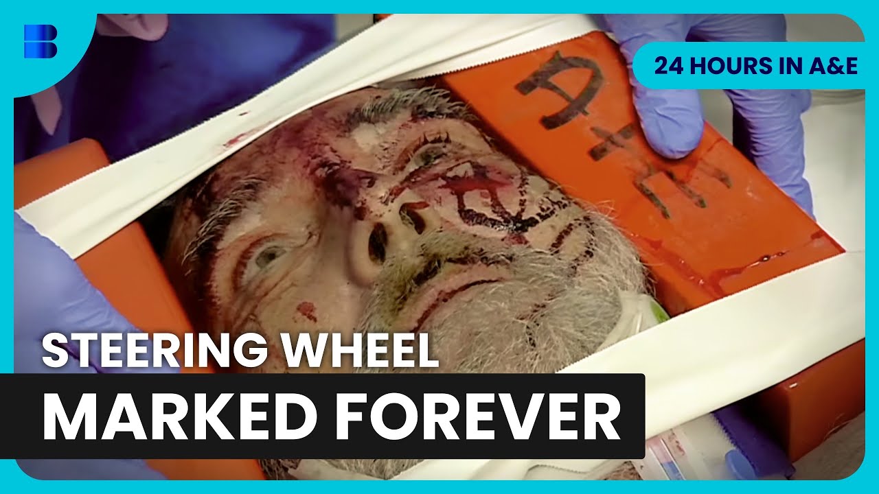 Lorry Driver Windscreen Impact Major Trauma | 24 Hours in A&E