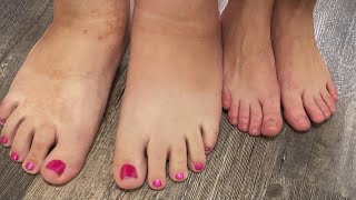 Webster Woman Has World Record For Worlds Largest Female Feet