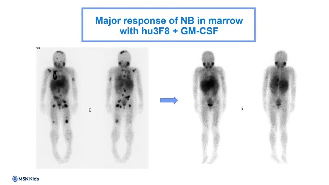 Dr Kim Kramer at the 2023 CNCF Parent & Caregiver Education Conference