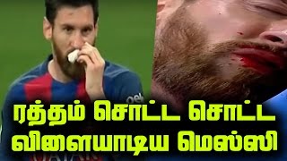 Real Hero Lionel Messi Bleeding In Ground ரததம சடட சடட வளயடய மஸஸ Unstoppable