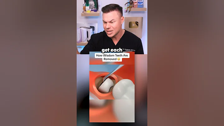 Dentist Reveals What REALLY Happens In Wisdom Teeth Removal! 🦷😭