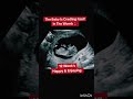 12 week Fetus happy and dancing in sonography #shortsfeed #pregnancy