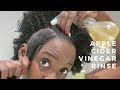 Apple Cider Vinegar Rinse | Dandruff Cure