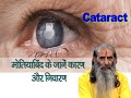  cataract    100    home cure for cataract  by swasth vichar