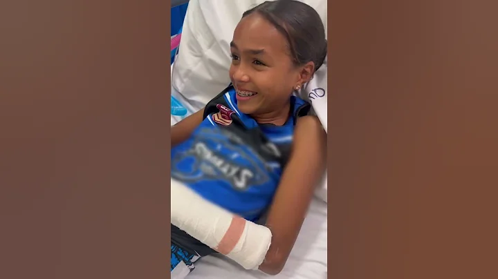 Broken arm #happygas