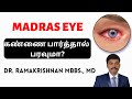 Madras eye dos  donts  madras eye  explained  dr ramakrishnan md