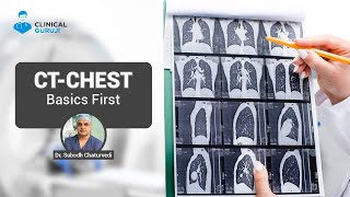 CT Chest - Basics First