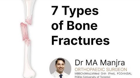 Types of Bone Fractures Explained: The Complete Visual Guide"