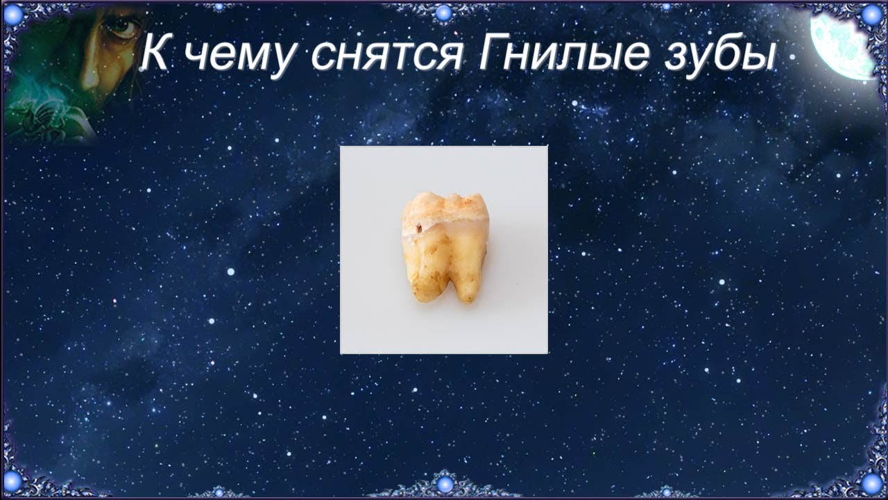 К чему снятся Гнилые зубы (Сонник)