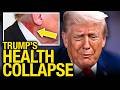 Trump's DESPERATE To Hide His Failing Health