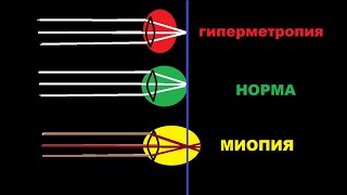Быстрое восстановление ЗРЕНИЯ САМОСТОЯТЕЛЬНО!