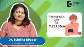 MELASMA/Dark Spots|Homeopathic Treatment Of Melasma#pigmentation -Dr.Sulekha Biradar|Doctors' Circle