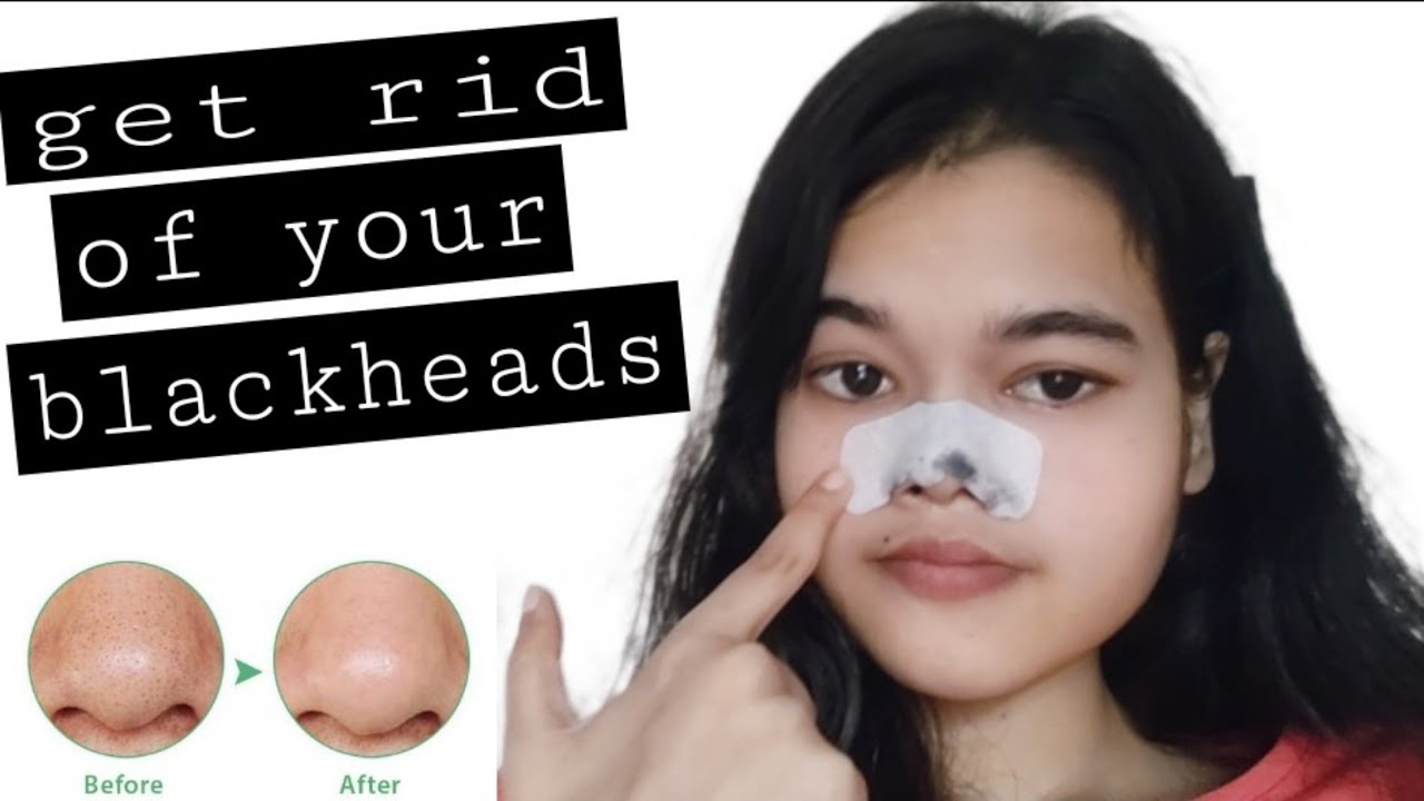 How to remove blackheads, Whiteheads from nose || charcoal nose strips ...