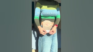 ✨ Convenience at its best! With Heagi 2-piece ostomy bags, switching is a breeze. #ostomybag #ostomy