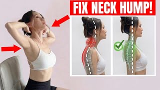 Fix Neck Hump, Forward Head, Tech Neck & Rounded Shoulders I 10 Min Posture Routine No Equipment