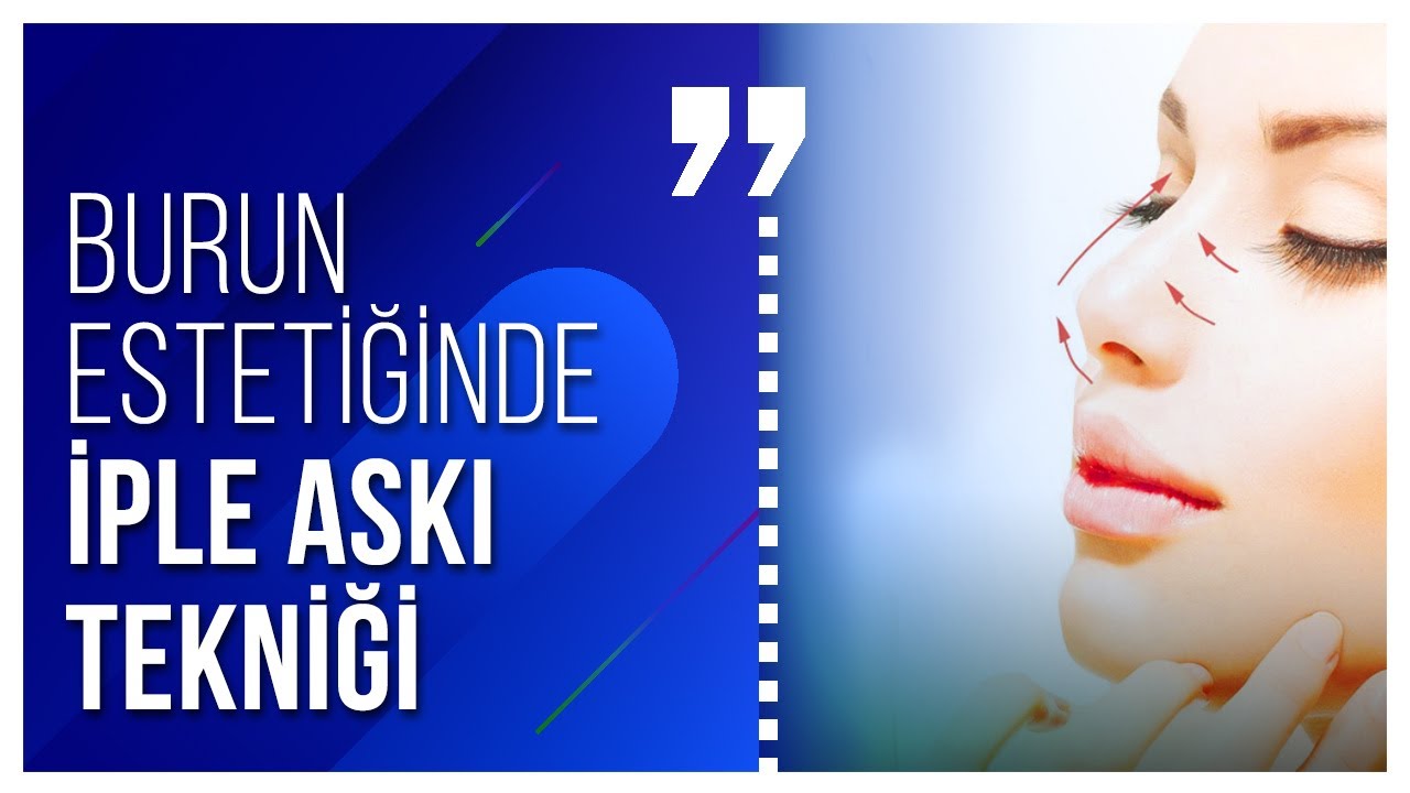 Burun estetiğinde iple askı tekniği