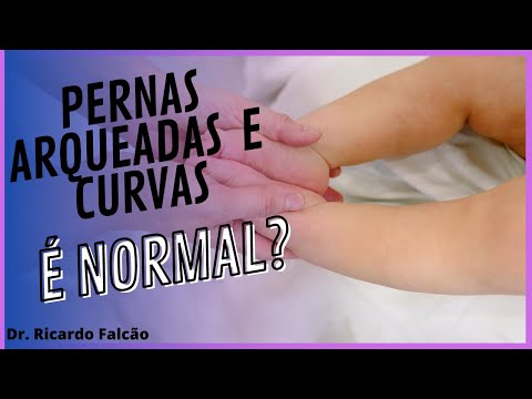 Vídeo: Todos os bebês andam com as pernas arqueadas?