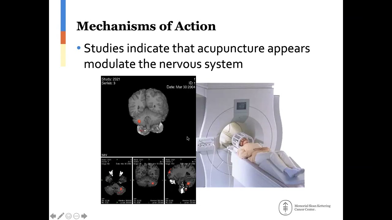 Breast Cancer Education Series: Alternative & Complimentary Medicine