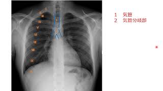 胸部X線写真読影キーワード解説動画1　胸部X線写真で見るべき構造物