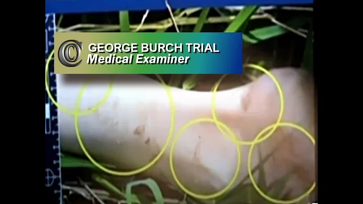GEORGE BURCH TRIAL -  Medical Examiner (2018)