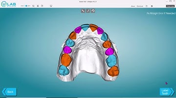 uDesign 10 - Creating a Retainer Case