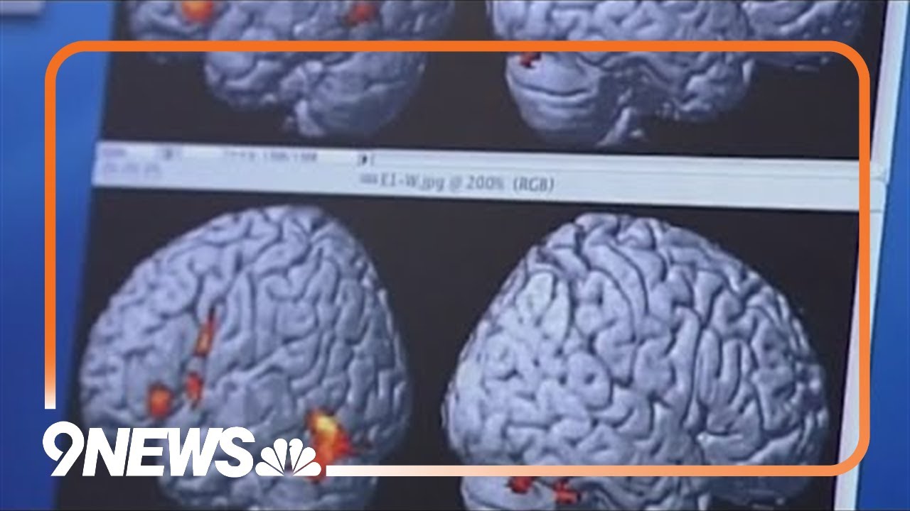 New blood test can detect cases of dementia