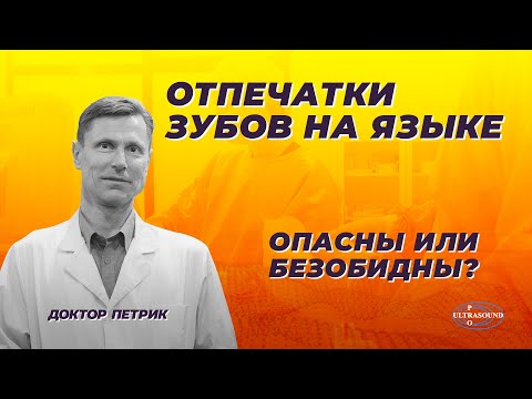 Отпечатки зубов на языке.Опасны или безобидны.