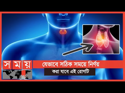 ভিডিও: আপটেক কোথায় হয়?