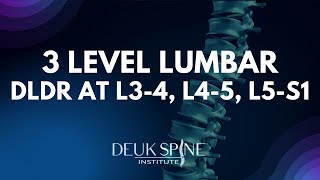 3 Level DLDR at  LT  3-4, RT L4-5, RT L5-S1 of the Lumbar Spine
