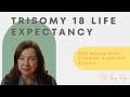 Trisomy 18 Life Expectancy | Will Babies With Edwards Syndrome Suffer?