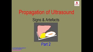 Propagation of Ultrasound - Signs & Artifacts - Part 2
