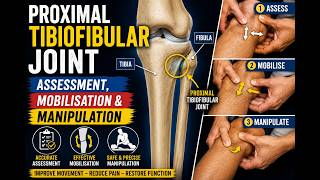 Proximal Tibiofibular Joint: Assessment, Mobilisation & Manipulation