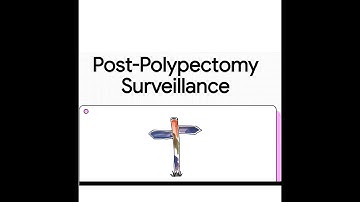 Post-Polypectomy Surveillance | Evidence-Based Guidelines for Clinicians
