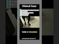 medical Quizzes #medical #medicalstudent #medicine #medicaleducation #nursing #nursingstudent #gnm
