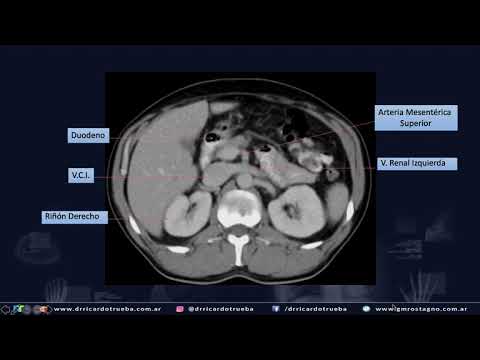 TOMOGRAFIA AXIAL BASICA DE ABDOMEN Y PELVIS