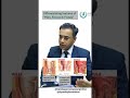 Piles , fissures and fistulas
