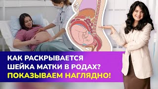 Как раскрывается шейка матки в родах? 👍🏻ПОКАЗЫВАЕМ НАГЛЯДНО!