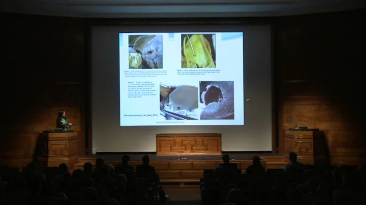 The pathology of sudden death - Mary Sheppard