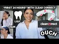 MY FIRST 24 HOURS WITH CLEAR CORRECT *invisible braces*