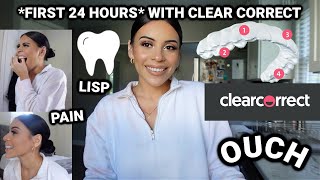 MY FIRST 24 HOURS WITH CLEAR CORRECT *invisible braces*