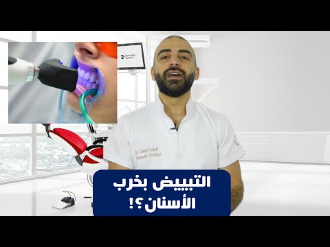 ضرر تبييض الاسنان بالليزر