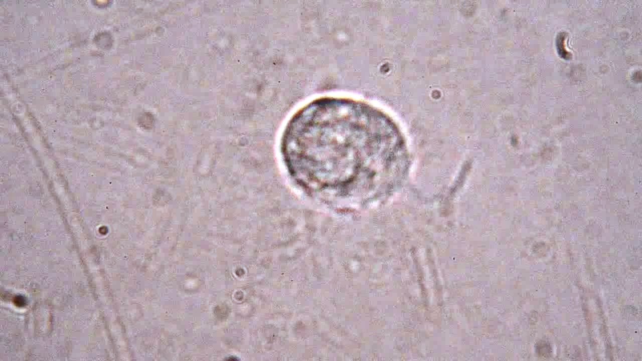 a pinworm által érintett szervek milyen gyorsan nő a condyloma