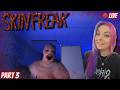 I wanna keep my skin... 🔴 | Skinfreak