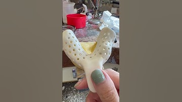 Perforated tray lower #partialdenture