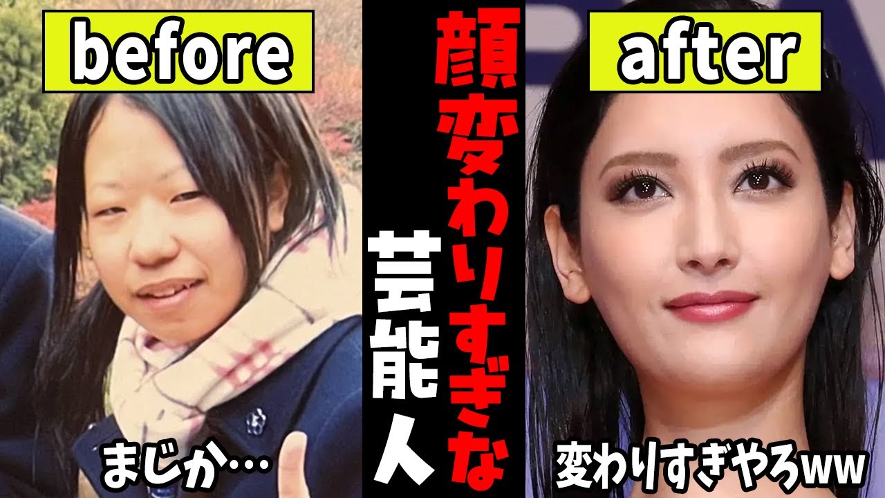 【ガルちゃん芸能】原型ない...顔変わりすぎな芸能人【有益2ch】