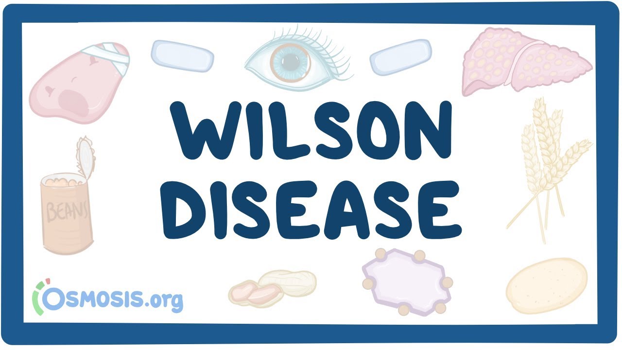 Wilson disease - causes, symptoms, diagnosis, treatment & pathology